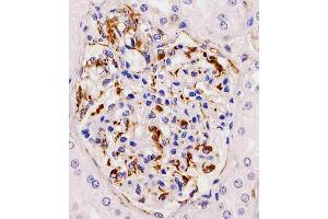 Antibody staining RHBDF2 in human kidney tissue sections by Immunohistochemistry (IHC-P - paraformaldehyde-fixed, paraffin-embedded sections). (RHBDF2 antibody  (N-Term))