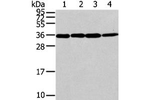 Western Blot analysis of Lovo, 293T, Jurkat and hela cell using CBX7 Polyclonal Antibody at dilution of 1/200 (CBX7 antibody)