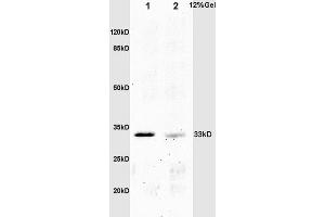 L1 mouse embryo lysates L2 mouse intestine lysates probed with Anti phospho-Crkl(Tyr251) Polyclonal Antibody, Unconjugated (ABIN703420) at 1:200 overnight at 4 °C.