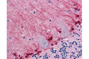 Immunohistochemistry (IHC) image for anti-Glycogenin 1 (GYG1) (AA 1-74) antibody (ABIN574263)