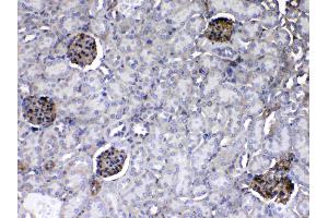 IHC analysis of Laminin using anti-Laminin antibody . (Laminin gamma 1 antibody  (all Isoforms))