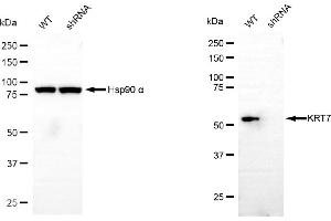 Western blotting analysis using keratin 7 antibody (ABIN7799187). (Recombinant Cytokeratin 7 antibody)