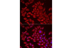 Immunofluorescence analysis of HeLa cell using AGPAT2 antibody.