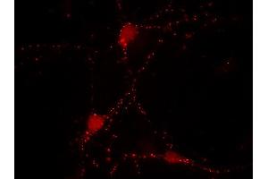 Indirect immunolabeling of cultured rat hippocampus neurons (dilution 1 : 500) (SYN2 antibody  (AA 440-458))
