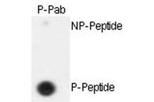 Dot blot analysis of ESPL1 (phospho S1126) polyclonal antibody  on nitrocellulose membrane.