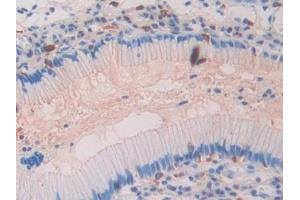 Immunohistochemistry (IHC) image for anti-CD63 (CD63) (AA 103-203) antibody (ABIN7433504)