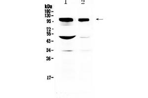 Western blot analysis of SAP102 using anti-SAP102 antibody . (DLG3 antibody  (AA 749-817))