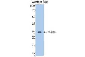 Western Blotting (WB) image for anti-serpin Peptidase Inhibitor, Clade A (Alpha-1 Antiproteinase, Antitrypsin), Member 10 (SERPINA10) (AA 278-425) antibody (ABIN1860973)