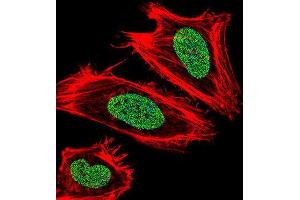 Immunofluorescence (IF) image for anti-Ubiquitin-Like, Containing PHD and RING Finger Domains, 1 (UHRF1) antibody (ABIN3003938) (UHRF1 antibody)