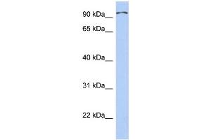 WB Suggested Anti-TRPC4AP Antibody Titration: 0.