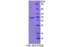 SDS-PAGE (SDS) image for Dystrobrevin Binding Protein 1 (DTNBP1) (AA 179-319) protein (His tag) (ABIN4989252)