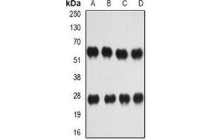 Western blot analysis of IL-27 expression in Hela (A), HepG2 (B), mouse spleen (C), mouse liver (D) whole cell lysates.