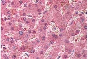 Human Liver (formalin-fixed, paraffin-embedded) stained with SERPINA1 antibody ABIN214380 at 2. (SERPINA1 antibody)