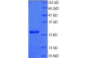 SDS-PAGE (SDS) image for Fibroblast Growth Factor 23 (FGF23) (AA 25-251), (full length) protein (His tag) (ABIN7479357)