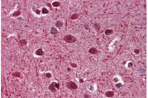 Human Brain, Cortex: Formalin-Fixed, Paraffin-Embedded (FFPE) (MAG antibody  (AA 119-209))