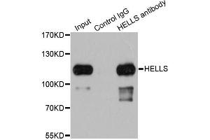 Immunoprecipitation analysis of 200 μg extracts of 293T cells using 1 μg HELLS antibody (ABIN5973444). (HELLS antibody)