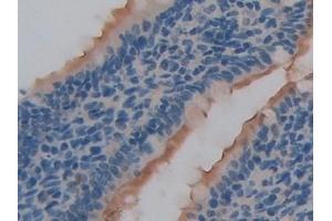 Detection of HPSE in Rat Small intestine Tissue using Polyclonal Antibody to Heparanase (HPSE)