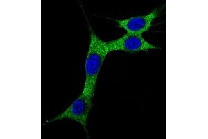 Immunofluorescence (IF) image for anti-Microtubule-Associated Protein 1 Light Chain 3 alpha (MAP1LC3A) (AA 89-120), (cleaved) antibody (ABIN388483)