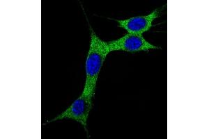 Immunofluorescent analysis of 4 % paraforldehyde-fixed, 0. (MAP1LC3A antibody  (cleaved))