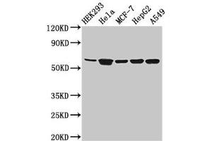 Western Blot Positive WB detected in: HEK293 whole cell lysate, Hela whole cell lysate, MCF-7 whole cell lysate, HepG2 whole cell lysate, A549 whole cell lysate All lanes: CYP4F22 antibody at 3. (CYP4F22 antibody  (AA 413-507))