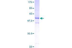 ASB9 Protein (AA 1-252) (GST tag)