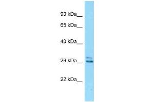 WB Suggested Anti-Eid2 Antibody Titration: 1. (EID2 antibody  (C-Term))