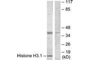 Western blot analysis of extracts from COLO205 cells, using Histone H3.