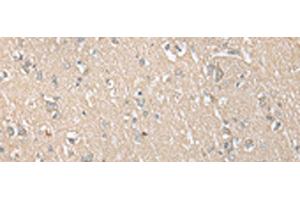 Immunohistochemistry of paraffin-embedded Human brain tissue using ECI1 Polyclonal Antibody at dilution of 1:30(x200) (DCI antibody)