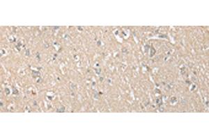 Immunohistochemistry of paraffin-embedded Human brain tissue using ECI1 Polyclonal Antibody at dilution of 1:30(x200)