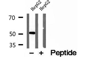 Western blot analysis of extracts of HepG2 cells, using NAPRT1 antibody. (NAPRT1 antibody  (Internal Region))