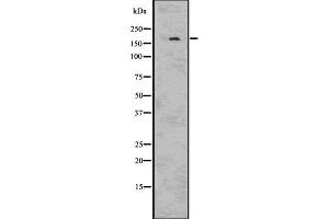 Western blot analysis IRS2 using HUVEC whole cell lysates (IRS2 antibody  (C-Term))