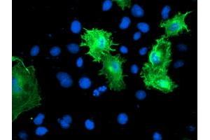 Anti-CNN2 mouse monoclonal antibody (ABIN2455129) immunofluorescent staining of COS7 cells transiently transfected by pCMV6-ENTRY CNN2 (RC221104). (CNN2 antibody)