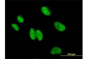 Immunofluorescence of purified MaxPab antibody to BCCIP on HeLa cell. (BCCIP antibody  (AA 1-314))