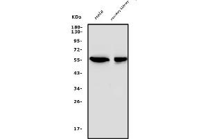 Western blot analysis of SGK1 using anti-SGK1 antibody (ABIN7603118).
