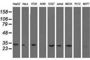 Western blot analysis of extracts (35 µg) from 9 different cell lines by using anti-ERCC1 monoclonal antibody. (ERCC1 antibody)