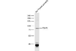 Western Blotting (WB) image for anti-Thyroid Stimulating Hormone Receptor (TSHR) (AA 501-600) antibody (ABIN668901)