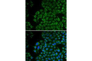 Immunofluorescence analysis of U2OS cell using TYR antibody. (TYR antibody)