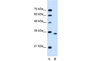 ACVR2B antibody used at 0. (ACVR2B antibody  (C-Term))