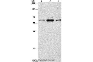 Western blot analysis of Human brain malignant glioma tissue, A172 and 293T cell, using ARHGEF7 Polyclonal Antibody at dilution of 1:800 (ARHGEF7 antibody)