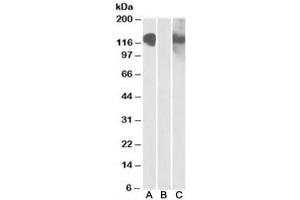 Western blot testing of HEK293 lysate overexpressing CDH11-MYC with CDH11 antibody [1ug/ml] in Lane A and with anti-MYC [1/1000] in lane C. (OB Cadherin antibody)