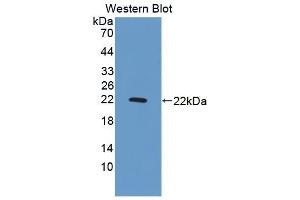 Detection of Recombinant GADD45a, Rat using Polyclonal Antibody to Growth Arrest And DNA Damage Inducible Protein Alpha (GADD45a) (GADD45A antibody  (AA 1-165))