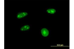 Immunofluorescence of purified MaxPab antibody to APTX on HeLa cell. (Aprataxin antibody  (AA 1-254))