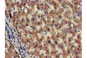 Immunohistochemistry of paraffin-embedded human liver tissue using ABIN7155985 at dilution of 1:100 (Hydroxyacid Oxidase 2 (HAO2) (AA 2-200) antibody)