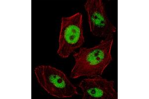 Fluorescent image of  cell stained with PHOX2B Antibody (Center) (ABIN655288 and ABIN2844878). (PHOX2B antibody  (AA 104-130))