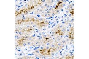 Immunohistochemical analysis of SET staining in mouse kidney formalin fixed paraffin embedded tissue section. (SET/TAF-I antibody)
