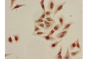Immunocytochemistry (ICC) image for anti-Histone Cluster 1, H3a (HIST1H3A) (acLys9) antibody (ABIN7139205)