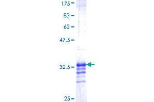ABI1 Protein (AA 185-238) (GST tag)