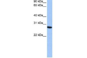 WB Suggested Anti-PSMA6 Antibody Titration:  0.