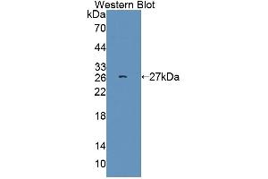 Detection of Recombinant SRSF1, Human using Polyclonal Antibody to Serine/Arginine Rich Splicing Factor 1 (SRSF1) (SRSF1 antibody  (AA 16-224))