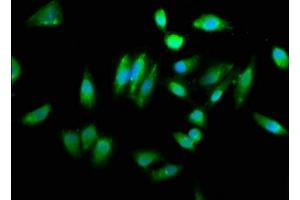 Immunofluorescence staining of Hela cells with ABIN7154130 at 1:260, counter-stained with DAPI. (CHAC1 antibody  (AA 43-264))